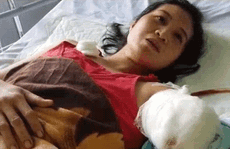 [Video] Cô giáo chạy xe 130km đi dạy gặp nạn mất cánh tay: Liên tục bị mất ngủ