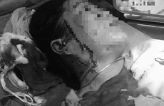 Bình Thuận: Hẹn đánh ghen, một phụ nữ bị đâm rách mặt