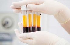 Covid-19: Hai người bệnh nặng hồi phục sau khi điều trị bằng huyết tương
