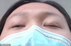Người phụ nữ ngủ vẫn mở mắt sau cắt mí 1 năm