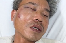 Nhân viên cây xanh bị đánh vì chụp hình băng rôn