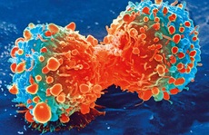 Phát hiện thứ ngay trong cơ thể 'khóa' được ung thư gan