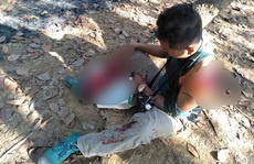Kinh hãi người đàn ông bị bò tót húc nát vai và chân ở Đồng Nai