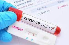 Chỉ số CT rất thấp nhưng ho, sốt nhẹ 2 ngày rồi hết có còn nguy cơ trở nặng?