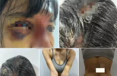 Siêu mẫu Khả Trang bị bạo hành đến 'thân tàn ma dại'?