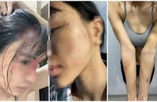 Điều tra vụ siêu mẫu Khả Trang 'tố' chồng chưa cưới hành hung
