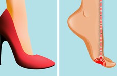 Những tác hại của việc đi giày cao gót thường xuyên