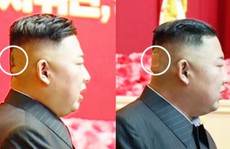 Ông Kim Jong-un bất ngờ xuất hiện với băng dán sau đầu