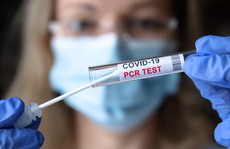 PCR với TC 31,1 - có nguy cơ lây không?