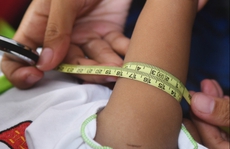 Suy dinh dưỡng vẫn là một thách thức lớn đối với trẻ em Đông Nam Á
