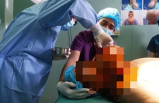 6 giờ nghẹt thở loại bỏ 'quả bom sắp nổ' trên mặt người đàn ông