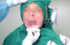 Người mang 'bom sắp nổ' trên mặt được cấy tế bào gốc