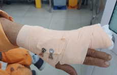 Nhân viên điện lực ở TP HCM bị tấn công