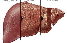 Bác sĩ  đưa 'bí kíp' bảo vệ lá gan ngày Tết