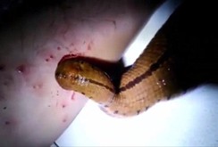 Đỉa nuôi khổng lồ nhờ hút máu chủ nhân