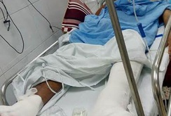 Bản tin NLĐ ngày 20-7: Đình chỉ ê kíp mổ lộn chân ở Bệnh viện Việt Đức