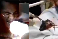 Clip: Gắp cá rô từ trong cổ họng bệnh nhân