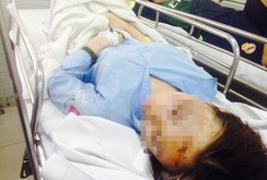 Bắt nghi can tạt axít hai nữ sinh viên