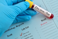 Bản tin NLĐ ngày 25-10: 30 điểm xét nghiệm virus Zika miễn phí ở TP HCM