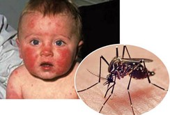 1% muỗi được xét nghiệm nghi ngờ mang virus zika