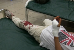 Tài xế Grab bị chém nát tay trước bến xe miền Tây