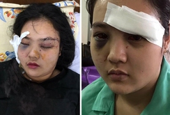 Bản tin NLĐ ngày 4-4 : Điều tra vụ thiếu nữ bị côn đồ hành hung dã man