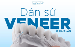 Làm đẹp nụ cười trước Tết: Xu hướng Veneer an toàn được nhiều người lựa chọn