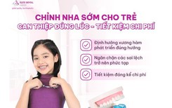 Chỉnh nha sớm cho trẻ: can thiệp đúng lúc – tiết kiệm chi phí