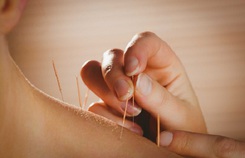 Châm cứu có hồi phục di chứng đột quỵ? Châm cứu có hồi phục di chứng đột quỵ?