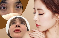 'Dao kéo' hỏng: Nỗi khổ của bệnh nhân và cái khó của bác sĩ 'Dao kéo' hỏng: Nỗi khổ của bệnh nhân và cái khó của bác sĩ