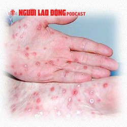 Cảnh báo ca bệnh giang mai tăng nhanh