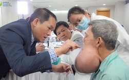 Chuyên gia đến từ Mỹ để hội chẩn ca bệnh 10 năm mang u quái khổng lồ trên mặt