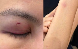 Công an phường Sài Gòn xác minh vụ ca sĩ Trung Quân Idol đánh phụ nữ