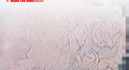 Tìm lai lịch thi thể có hình xăm rồng