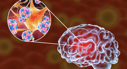 14 giờ chiều nay, talkshow: “Sự nguy hiểm của viêm màng não: Phát hiện, điều trị ra sao?