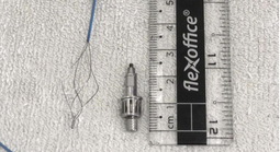 Sau trồng răng implant, bất ngờ phát hiện dị vật mắc trong phế quản