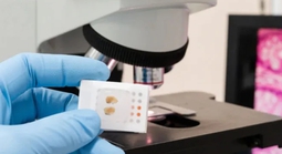 Thêm tiềm năng của AI trong cải thiện điều trị ung thư