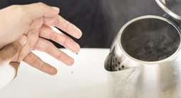 Bé 9 tháng tuổi bỏng 30% cơ thể do kéo dây nguồn ấm siêu tốc