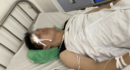 Xe buýt va chạm nhẹ với xe con, tài xế bị đánh chấn thương