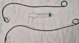 Bệnh nhân ở Cà Mau "bỏ quên" ống thông JJ trong người suốt hơn 10 năm