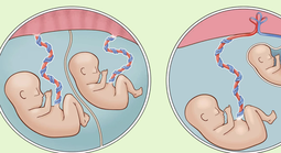 Bé trai nặng chưa đầy 1 kg được cứu sống thần kỳ