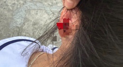 Xác minh vụ cô giáo ở Phú Quốc nhéo tai học sinh lớp 1 đến chảy máu