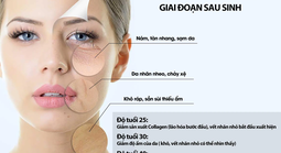 Hành trình phục hồi da sau sinh – dễ bắt đầu hơn mẹ nghĩ