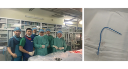 Ống thông truyền hóa chất bị bỏ quên suốt 3 năm, đứt trôi vào tim người phụ nữ