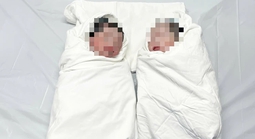 Liên tiếp tin vui cho sản phụ song thai bị đứt lìa bàn tay