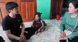 Bé gái 4 tuổi bị chó thả rông lao vào tấn công: Truy xuất camera tìm chủ nhân vật nuôi