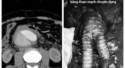 Du khách nước ngoài nguy kịch, bác sĩ Việt cứu sống ngoạn mục