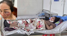 Làm rõ việc tiểu thương tố bị hành hung