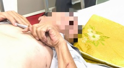 Nam tài xế nguy kịch vì bị chó cắn