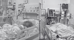 Hai chị em nguy kịch do cha ruột phóng hỏa đốt phòng trọ